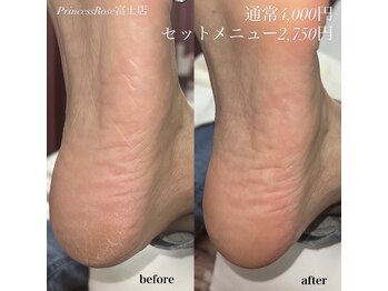 キレイシェア バイ プリンセスローズ静岡駅店(KIREI SHARE)/足の裏のケア!