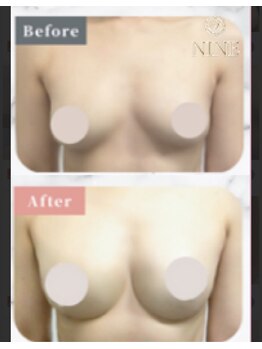 ブエナイン(Buenaine)の写真/☆男性限定☆女性へのですがプレゼントで整体30分施術ゲット