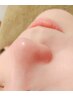 【エステ☆美たまご毛穴エクストラクション&顔ワックス】デコルテ背中ケア付