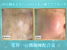 リメイク 広尾(REMAKE)の雰囲気（ハーブピーリングを越える肌質改善術｜幹細胞ゴールドピーリング）