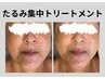 【たるみ・小顔・二重顎】40代からはじめるたるみ集中トリートメント