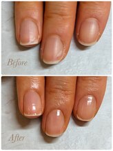 ソワン(soin)/当日ビフォーアフター