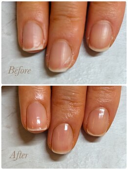 ソワン(soin)/当日ビフォーアフター