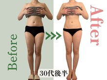 アムール(Amour)/巻き肩、猫背悩み｜30代後半