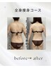 【7月限定】強力マシンで頑固な脂肪を撃退！痩身体験120分/￥8600