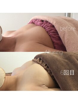 アルアリング 春日原(Alluring)/6回モニター様ビフォーアフター