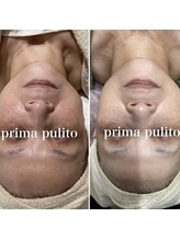 プリマプリート 可児店/白玉スノーピール！