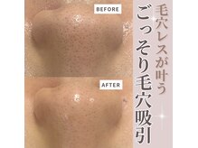 サロンドブランシール(salon de blanchir)の雰囲気（ごっそり毛穴洗浄でザラつきのないツルスベ肌が実現！）