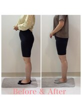 スタイルラボ高松/産後骨盤矯正の効果♪