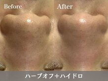 トウメイコガオ 横浜店/トウメイコガオでハーブ