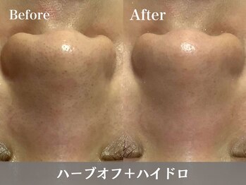 トウメイコガオ 横浜店/トウメイコガオでハーブ