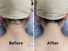 サロンアメリ 御座店(Salon Ameri)の雰囲気（《ルミクスA9実績高知No.1》違いがわかるサロンアメリ♪）