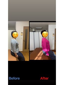 ヴィバランス(Vebalance)/猫背矯正