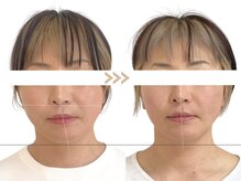 メラリノ(Melalino)/シンメトリー小顔整美♪