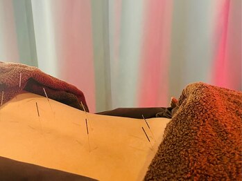 ジネコラボ 横浜(Gyneco-labo)/妊活中の体質ケア/鍼灸