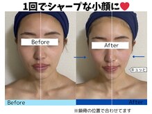 お顔の研究所/ビフォーアフター写真♪