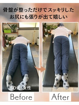 ウェルビーイング整体院 水戸赤塚店(wellbeing整体院)/Before After