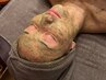 メンズ【ハーブピーリング】根本ニキビケア・髭剃り等による肌荒れ改善