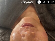 アングレイス(Anngrace)/護りの抗酸化【ポールシェリー】