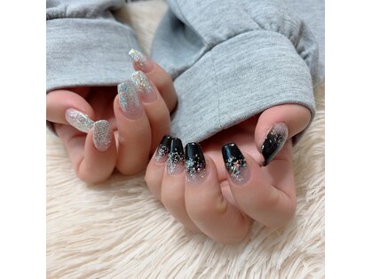 Total beauty salon Precious 小顔/フェイシャル/脱毛/痩身/ヘッドスパ/シミ/たるみの写真