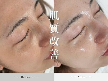 ミーティスの写真