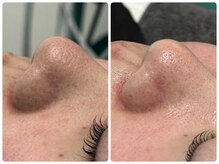 フェリーチェ 海老名(Felice)/フェイシャルBA