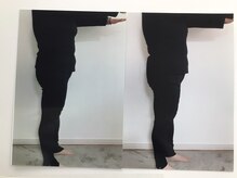 ヨサパーク エテノア(YOSAPARK etenoa)の雰囲気（３回で変わるダイエットコース　右→初回　左→3回目）