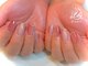 ユーネイル(U-nail)の写真