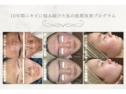 ベル(Belle)の写真