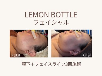 ビーモア(B.MORE)/レモンボトルで小顔ケア♪