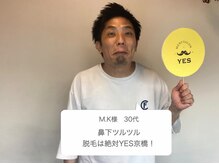 イエス 大阪難波店(YES)/他サロンにない圧倒的脱毛効果！