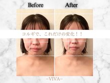 ビバ(VIVA)