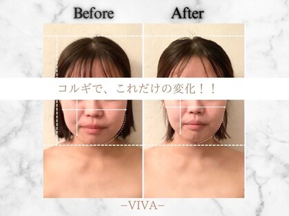 ビバ(VIVA)の写真