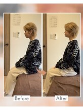 藤沢南口整体サロン/20代女性　猫背を矯正！