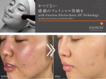 ハルム(HaluM)の雰囲気（納得できる効果を実感◎毛穴レスな艶肌へ導くエンビロンの応用。）