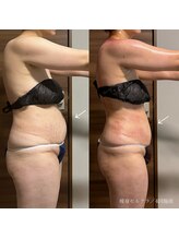 エクラ(eclat)/セルクラ