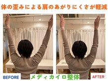 四条大宮アシスト鍼灸整骨院/全身整体ビフォーアフター