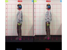 ケアルーム 茅ヶ崎(CAREroom)/施術効果写真☆（before after）