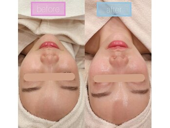 ベルチェリカ(Belle CHERIKA)/クリスティーナ・アンストレス