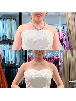 ディア スプリーマ/前から別人に!!顔も変わります!!