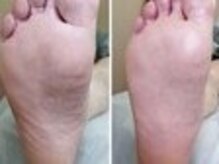 リゼラアンドコー 天童・PONO/ドイツ式フットケア専門店