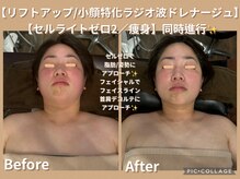 ボディリカバリー(Bodyリカバリー)/