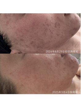 ココロ(COCORO)/最新・世界初・杉並初導入