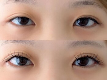 シャール(shall)/エクパ/竹内