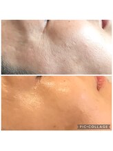 グラチア(Gratiae)/40代/3ヶ月改善プログラム