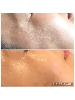 グラチア(Gratiae)/40代/3ヶ月改善プログラム