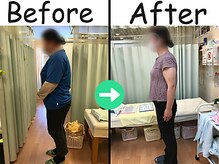 杉本接骨鍼灸院/【ダイエット】46歳　33キロ！