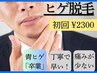 ホットペッパー限定価格！　ひげ脱毛　(顔全体+首脱毛)　初回　¥2300