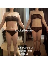 エステサロン ルックス ビューティー(エステサロン Looks Beauty)/痩身ハイパーナイフ