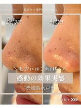 ノイ(Noi.)/Before-After